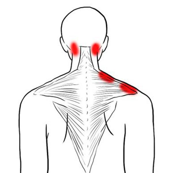 Поражают люди, у которых годами болит шея, между лопатками горит, руки немеют по ночам, а они продолжают мазать гелем и пить таблетки.