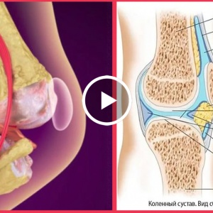 Вылечи колени и восстанови кости и суставы с этим рецептом